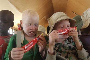 Mitindo Albinism Center Outreach - Image 4